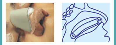 Produtos para Cirurgia Plástica